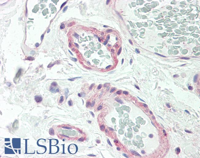CALCR / Calcitonin Receptor Antibody - Anti-CALCR / Calcitonin Receptor antibody IHC staining of human colon, vessels. Immunohistochemistry of formalin-fixed, paraffin-embedded tissue after heat-induced antigen retrieval. Antibody dilution 1:50.