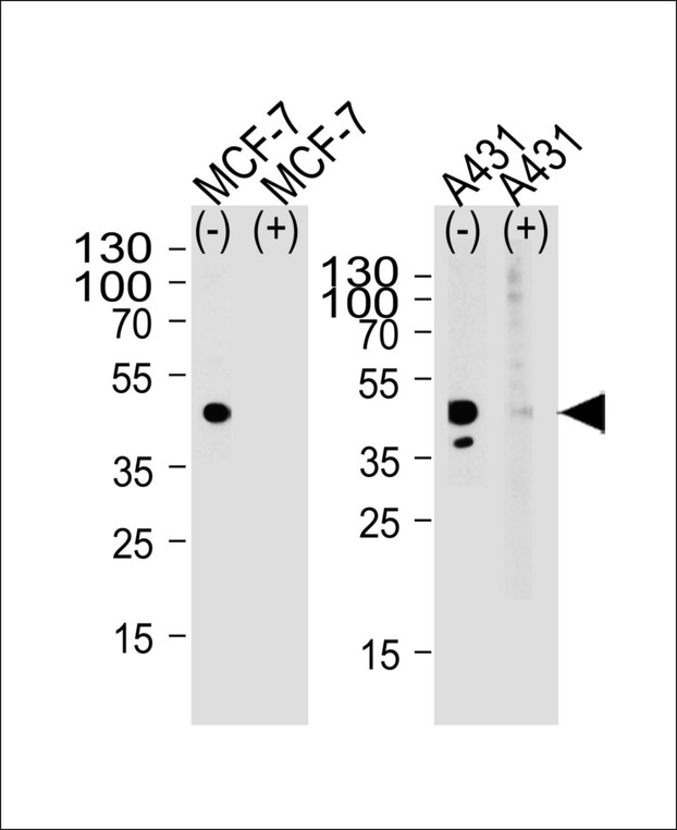 CALCR / Calcitonin Receptor Antibody - Western blot of lysate from MCF-7, A431 cell line, using CALCR Antibody with(+) or without(-) peptides. Antibody was diluted at 1:1000 at each lane. A goat anti-rabbit(HRP) at 1:5000 dilution was used as the secondary antibody. Lysate at 35ug per lane.