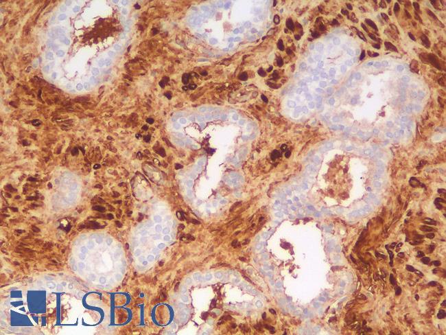 CALD1 / Caldesmon Antibody - Human Prostate: Formalin-Fixed, Paraffin-Embedded (FFPE)