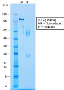 CALD1 / Caldesmon Antibody - SDS-PAGE Analysis Purified Caldesmon Rabbit Recombinant Monoclonal Antibody (CALD1/1424R). Confirmation of Purity and Integrity of Antibody.
