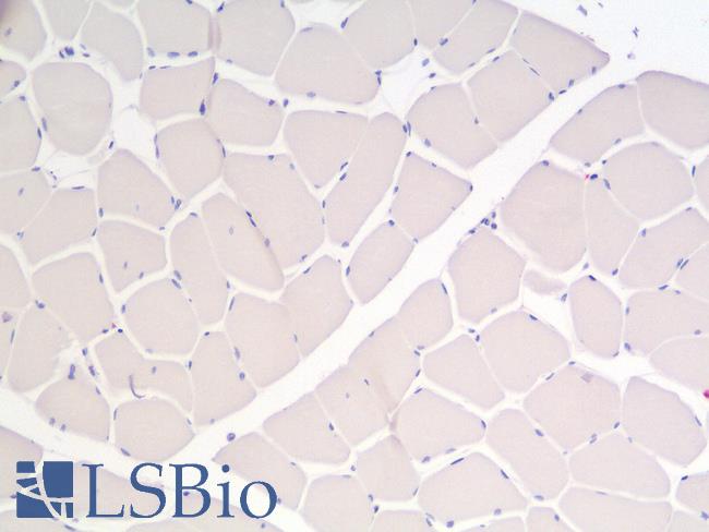 CALD1 / Caldesmon Antibody - Human Skeletal Muscle, Negative Control Tissue: Formalin-Fixed, Paraffin-Embedded (FFPE)