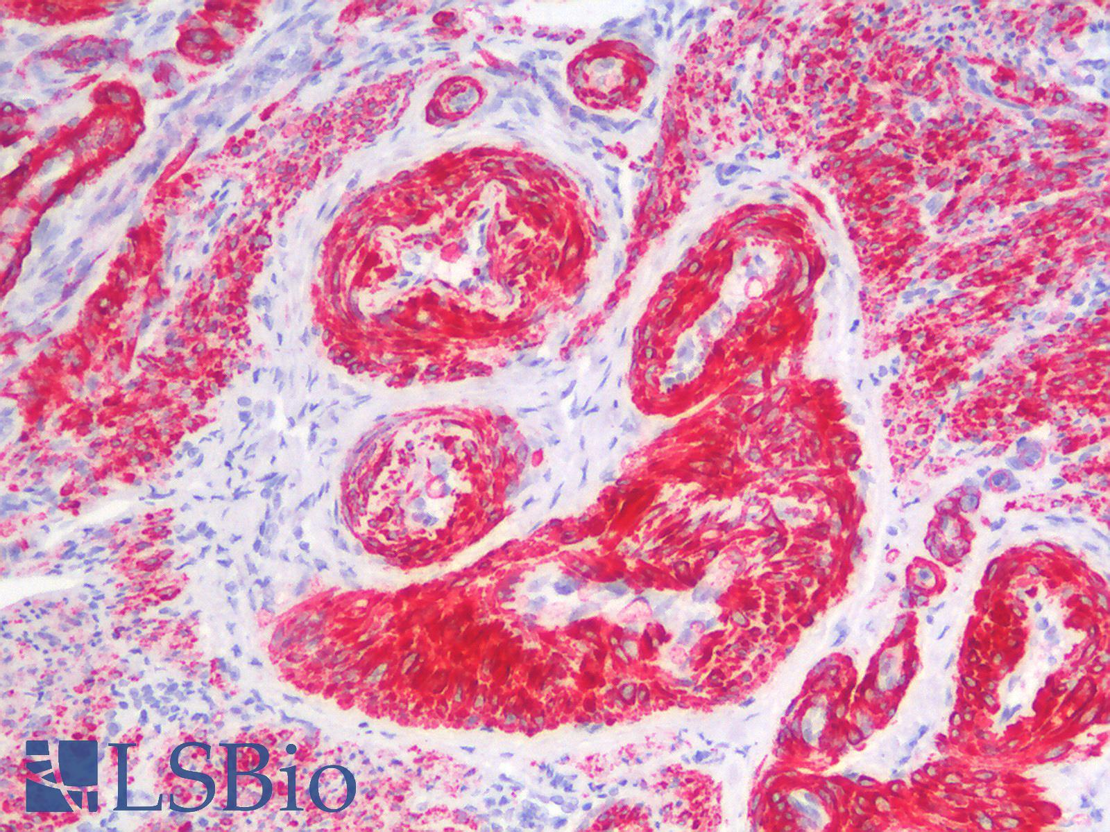 CALD1 / Caldesmon Antibody - Human Uterus, Negative Control Tissue: Formalin-Fixed, Paraffin-Embedded (FFPE)