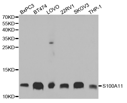Calgizzarin / S100A11 Antibody - Western blot analysis of extracts of various cell lines, using S100A11 antibody.