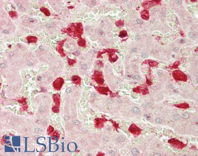 Calgizzarin / S100A11 Antibody - Human Liver: Formalin-Fixed, Paraffin-Embedded (FFPE)