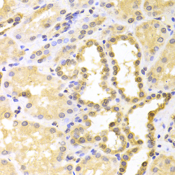 Calgizzarin / S100A11 Antibody - Immunohistochemistry of paraffin-embedded human kidney tissue.