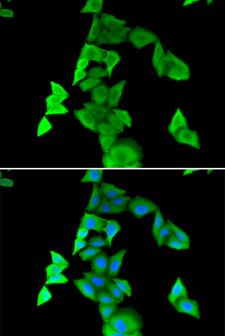Calgizzarin / S100A11 Antibody - Immunofluorescence analysis of MCF-7 cells.