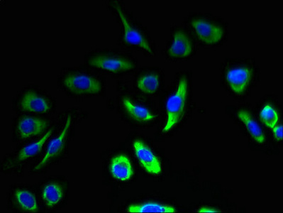 CALM1 / Calmodulin Antibody - Immunofluorescent analysis of A549 cells using CALM1 Antibody at dilution of 1:100 and Alexa Fluor 488-congugated AffiniPure Goat Anti-Rabbit IgG(H+L)
