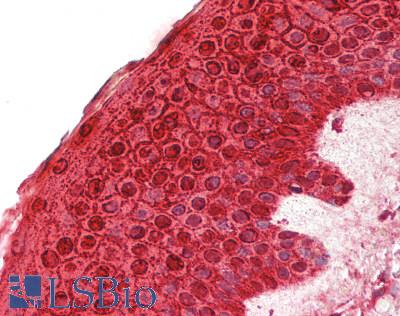 CALML5 Antibody - Human Skin: Formalin-Fixed, Paraffin-Embedded (FFPE)