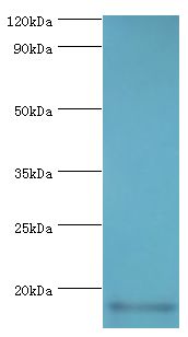 CALML5 Antibody - Western blot. All lanes: Calmodulin-like protein 5 antibody at 12 ug/ml+A431 whole cell lysate. Secondary antibody: Goat polyclonal to rabbit at 1:10000 dilution. Predicted band size: 16 kDa. Observed band size: 16 kDa Immunohistochemistry.