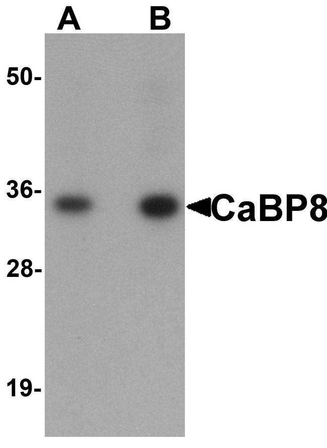 Calneuron-1 / CALN1 Antibody - Western blot analysis of CaBP8 in 3T3 cell lysate with CaBP8 antibody at (A) 1 and (B) 2 ug/ml.