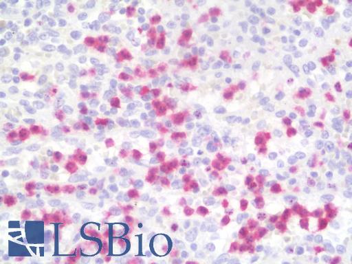 Calprotectin Antibody - Anti-Calprotectin antibody IHC staining of human spleen. Immunohistochemistry of formalin-fixed, paraffin-embedded tissue after heat-induced antigen retrieval. Antibody dilution 1:50.