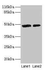 CALR / Calreticulin Antibody - Western blot All lanes: Calreticulin antibody at 2µg/ml Lane 1: EC109 whole cell lysate Lane 2: 293T whole cell lysate Secondary Goat polyclonal to rabbit IgG at 1/10000 dilution Predicted band size: 48 kDa Observed band size: 48 kDa