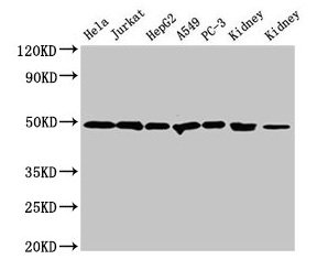 CALR / Calreticulin Antibody - Western Blot Positive WB detected in: Hela whole cell lysate, Jurkat whole cell lysate, HepG2 whole cell lysate, A549 whole cell lysate, PC-3 whole cell lysate, Rat kidney tissue, Mouse kidney tissue All lanes: CALR antibody at 2µg/ml Secondary Goat polyclonal to rabbit IgG at 1/50000 dilution Predicted band size: 49 kDa Observed band size: 49 kDa