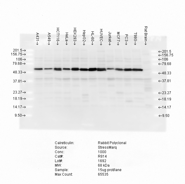 CALR / Calreticulin Antibody - Western blot analysis of Calreticulin in various cell lysates, using a 1:1000 dilution of Calreticulin antibody.