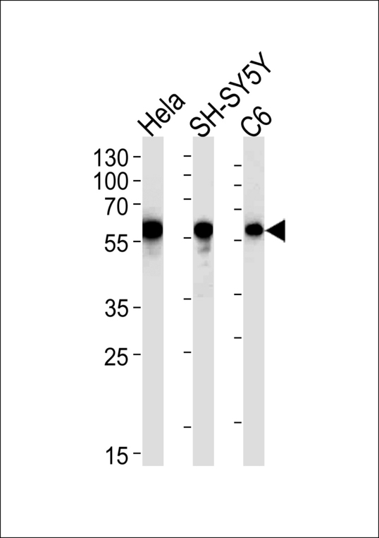 CALR / Calreticulin Antibody - CALR Antibody western blot of HeLa,SH-SY5Y,rat C6 cell line lysates (35 ug/lane). The CALR antibody detected the CALR protein (arrow).