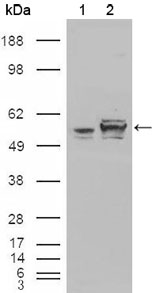 CALR3 Antibody - Western blot using Calreticulin mouse monoclonal antibody against HEK293T cells transfected with the pCMV6-ENTRY control (1) and pCMV6-ENTRY Calreticulin cDNA (2).