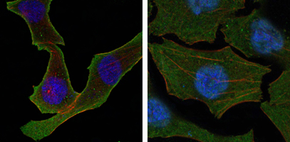 CALR3 Antibody - Confocal immunofluorescence of SKBR-3 (left) and A549 (right) cells using Calreticulin mouse monoclonal antibody (green). Red: Actin filaments have been labeled with DY-554 phalloidin. Blue: DRAQ5 fluorescent DNA dye.