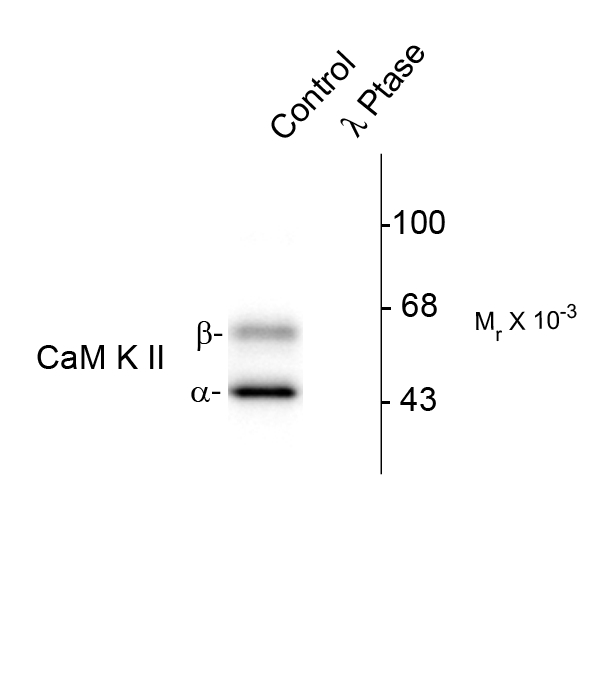 CAMK2 / CAMKII Antibody - Western blot of rat brain lysate showing specific immunolabeling of the ~50k a- and the ~60k b-CaM Kinase II phosphorylated at Thr286 (Control). The phosphospecificity of this labeling is shown in the second lane (lambda-phosphatase: l-Ptase). The blot is identical to the control except that it was incubated in l-Ptase (1200 units for 30 min) before being exposed to the Anti-Thr286 CaM Kinase II. The immunolabeling is completely eliminated by treatment with l-Ptase.