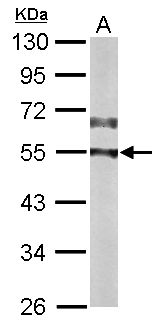 CAMK2D / CaMKII Delta Antibody - Sample (50 ug of whole cell lysate). A: Mouse brain. 10% SDS PAGE. CaMKII Delta / CAMK2D antibody diluted at 1:10000.