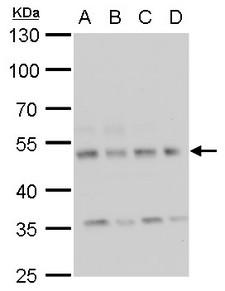 CAMK2D / CaMKII Delta Antibody - Sample (30 ug of whole cell lysate). A: 293T, B: A431, C: HeLa, D: HepG2. 10% SDS PAGE. CaMKII Delta / CAMK2D antibody diluted at 1:1000.