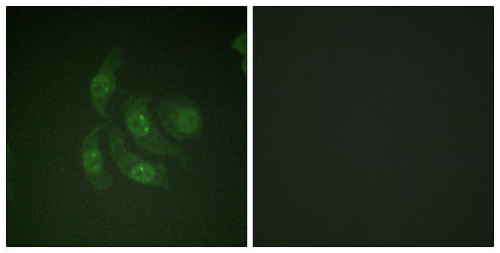 CAMK4 / CaMK IV Antibody - Immunofluorescence analysis of HepG2 cells, using CaMK4 Antibody. The picture on the right is blocked with the synthesized peptide.