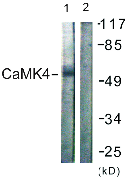 CAMK4 / CaMK IV Antibody - Western blot analysis of lysates from K562 cells, treated with H2O2 100uM 30', using CaMK4 Antibody. The lane on the right is blocked with the synthesized peptide.