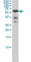 CAMK4 / CaMK IV Antibody - Western blot of CAMK4 expression in Jurkat cell lysate.