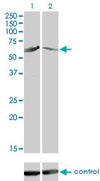 CAMK4 / CaMK IV Antibody - Western blot of CAMK4 over-expressed 293 cell line, cotransfected with CAMK4 Validated Chimera RNAi (Lane 2) or non-transfected control (Lane 1). Blot probed with CAMK4 antibody. GAPDH ( 36.1 kD ) used as specificity and loading control.