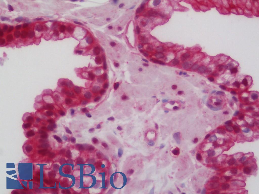 CAMKK2 Antibody - Human Prostate: Formalin-Fixed, Paraffin-Embedded (FFPE)