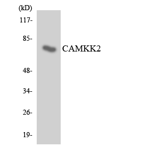 CAMKK2 Antibody - Western blot analysis of the lysates from HeLa cells using CAMKK2 antibody.
