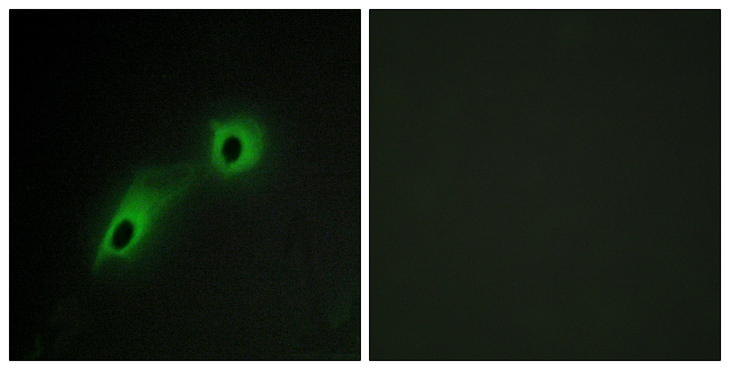 CAMKV Antibody - Immunofluorescence analysis of HeLa cells, using CAMK5 Antibody. The picture on the right is blocked with the synthesized peptide.