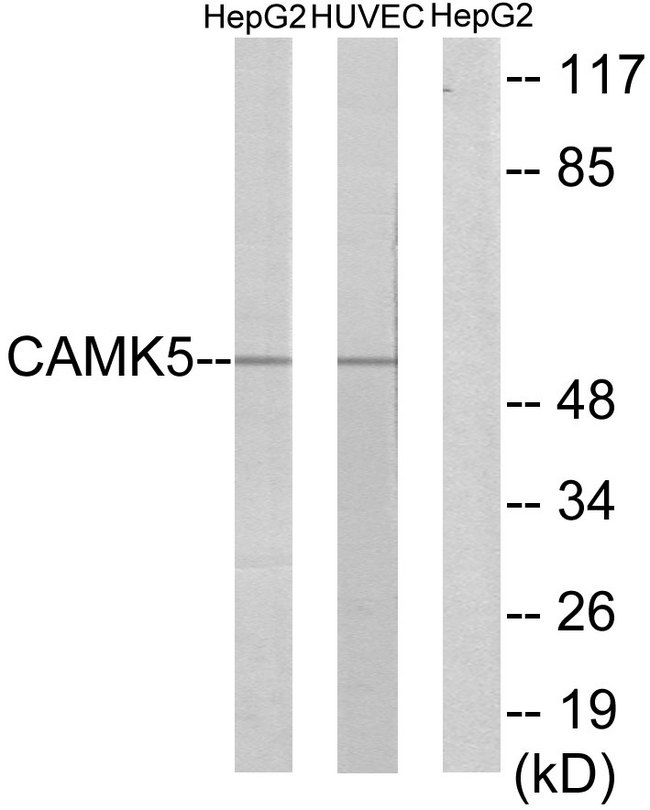 CAMKV Antibody - Western blot analysis of lysates from HepG2 and HUVEC cells, using CAMK5 Antibody. The lane on the right is blocked with the synthesized peptide.