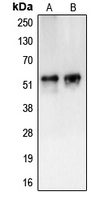 CAMKV Antibody - Western blot analysis of CAMKV expression in HL60 (A); HUVEC (B) whole cell lysates.