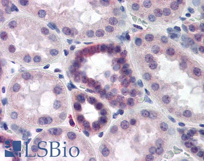 CAND2 / TIP120B Antibody - Anti-CAND2 / TIP120B antibody IHC of human kidney. Immunohistochemistry of formalin-fixed, paraffin-embedded tissue after heat-induced antigen retrieval. Antibody dilution 1:500.