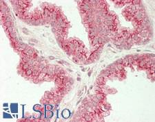 CANT1 Antibody - Human Prostate: Formalin-Fixed, Paraffin-Embedded (FFPE)