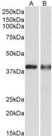 CAPG Antibody - CAPG antibody (0.3 ug/ml) staining of U937 (A) and Human Spleen (B) lysates (35 ug protein in RIPA buffer). Primary incubation was 1 hour. Detected by chemiluminescence.