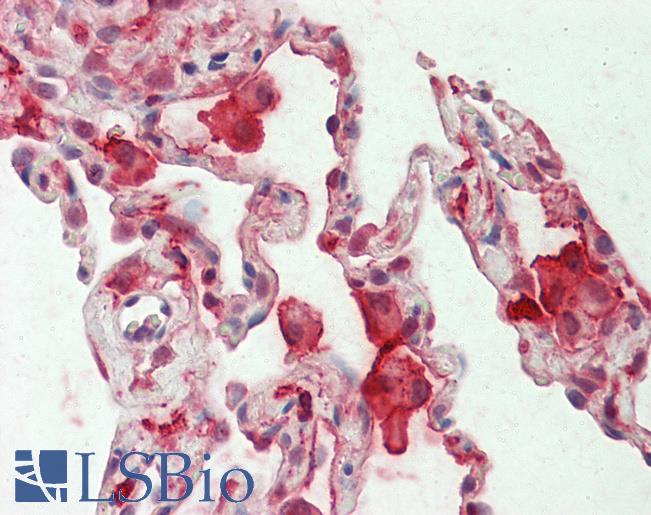 CAPG Antibody - Anti-CAPG / MCP antibody IHC staining of human lung. Immunohistochemistry of formalin-fixed, paraffin-embedded tissue after heat-induced antigen retrieval. Antibody concentration 5 ug/ml.