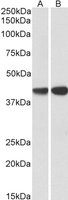 CAPG Antibody - CAPG Antibody (0.3?/ml) staining of Periheral Blood Lymphocytes (CAPG Antibody (aa147-159) lane A), (CAPG Antibody (aa205-217) lane B) lysates (35? protein in RIPA buffer). Primary incubation was 1 hour. Detected by chemiluminescence.