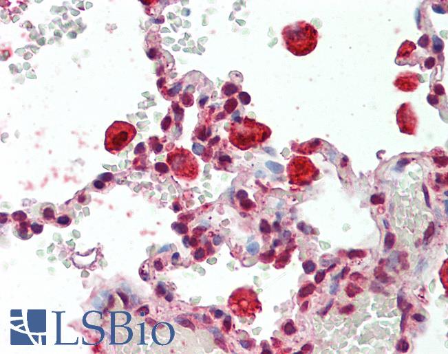 CAPG Antibody - Human Lung, Macrophages: Formalin-Fixed, Paraffin-Embedded (FFPE)