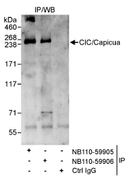 Capicua / CIC Antibody - Detection of Human CIC/Capicua by Western Blot of Immunoprecipitates. Samples: Whole cell lysate (1 mg for IP, 20% of IP loaded) from HeLa cells. Antibodies: Affinity purified rabbit anti-CICa antibody used for IP at 3 mcg/mg lysate. CIC was also immunoprecipitated by rabbit anti-CICa antibody, which recognizes a downstream epitope.  This image was taken for the unconjugated form of this product. Other forms have not been tested.