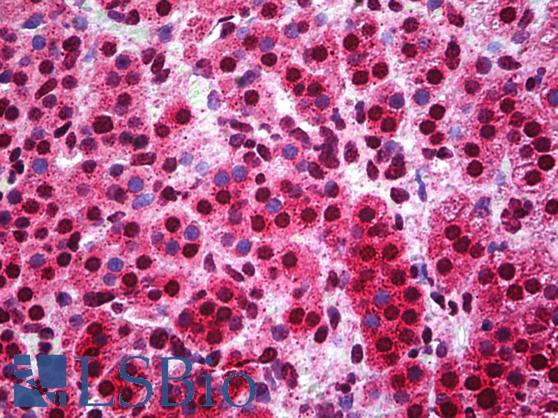 Capicua / CIC Antibody - Anti-CIC antibody IHC of human adrenal. Immunohistochemistry of formalin-fixed, paraffin-embedded tissue after heat-induced antigen retrieval. Antibody concentration 5 ug/ml.  This image was taken for the unconjugated form of this product. Other forms have not been tested.
