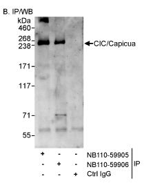 Capicua / CIC Antibody - Detection of Human CIC/Capicua by Western Blot and Immunoprecipitation. Samples: 1 mg for IP, 20% of IP loaded and 293T (T; 50 mcg) cells. Antibodies: Affinity purified rabbit anti- CIC antibody used for WB at 1 mcg/ml (A and B) and used for IP at 3 mcg/mg lysate. CIC was also immunoprecipitated by rabbit anti-CIC antibody which recognizes an upstream epitope.  This image was taken for the unconjugated form of this product. Other forms have not been tested.