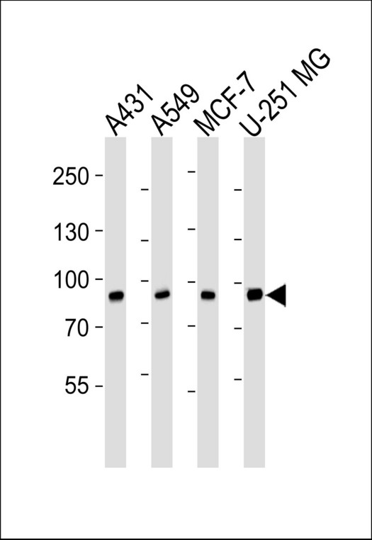 CAPN1 / Calpain 1 Antibody - Western blot of lysates from A431, A549, MCF-7, U-251 MG cell line (from left to right) with CAPN1 Antibody. Antibody was diluted at 1:1000 at each lane. A goat anti-mouse IgG H&L (HRP) at 1:3000 dilution was used as the secondary antibody. Lysates at 35 ug per lane.