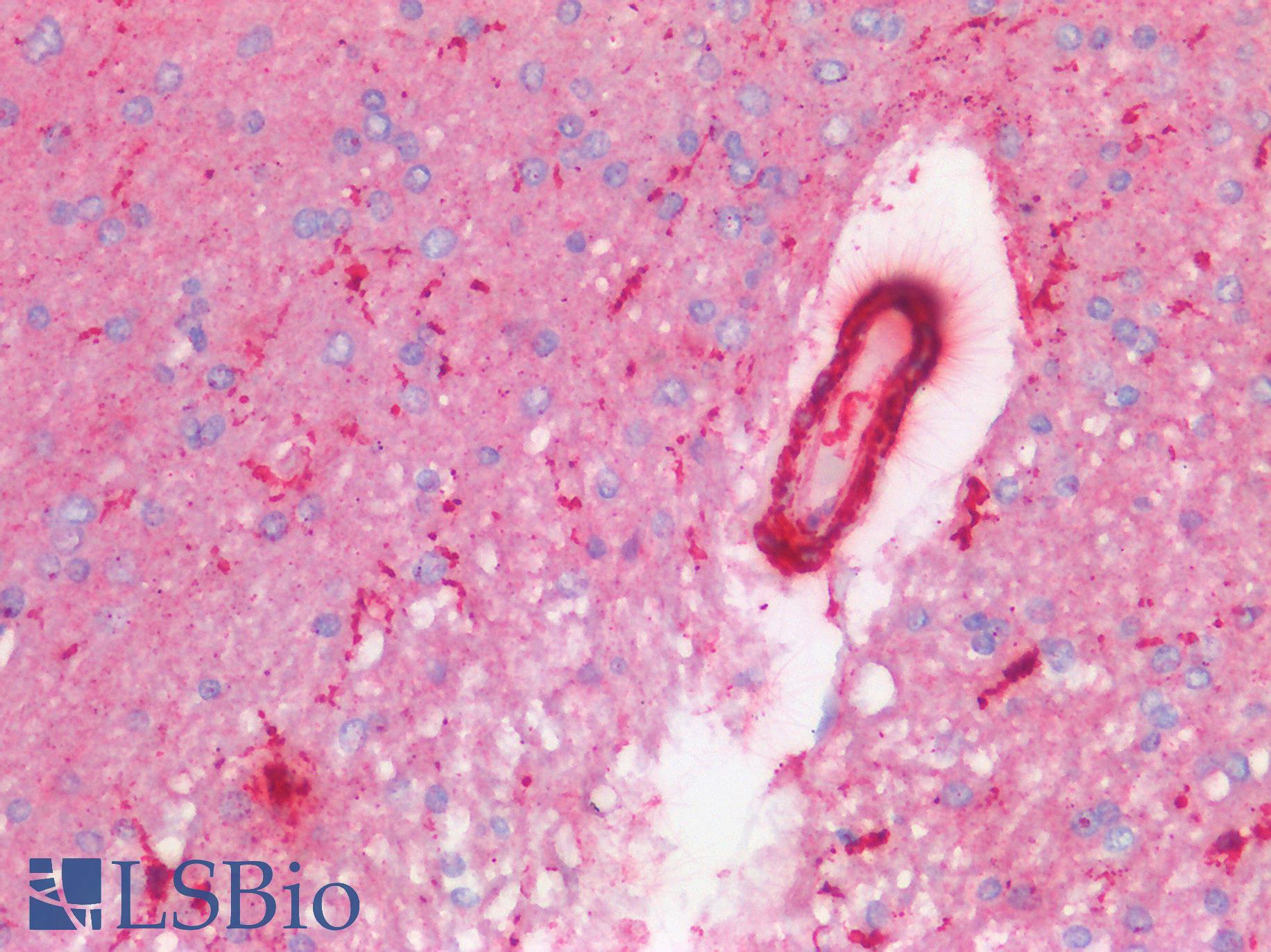 CAPN1 / Calpain 1 Antibody - Human Brain, Cortex Alzheimer's Disease: Formalin-Fixed, Paraffin-Embedded (FFPE)
