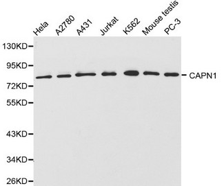 CAPN1 / Calpain 1 Antibody - Western blot of CAPN1 pAb in extracts from Hela, A2780, A431, Jurkat, K562,PC3 cells and mouse testis tissue.