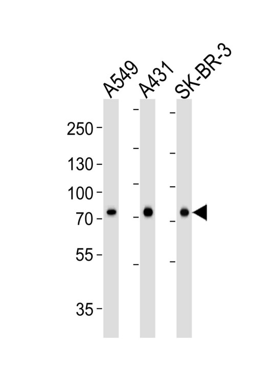 CAPN2 / Calpain 2 / M-Calpain Antibody - Western blot of lysates from A549, A431, SK-BR-3 cell line (from left to right) with CAPN2 Antibody. Antibody was diluted at 1:1000 at each lane. A goat anti-mouse IgG H&L (HRP) at 1:3000 dilution was used as the secondary antibody. Lysates at 35 ug per lane.