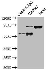 CAPN2 / Calpain 2 / M-Calpain Antibody