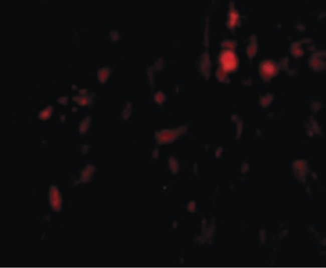 CAPN6 / Calpain 6 Antibody - Immunofluorescence of CAPN6 in Human Lung cells with CAPN6 antibody at 20 ug/ml.