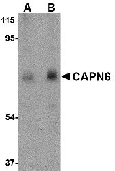 CAPN6 / Calpain 6 Antibody - Western blot of CAPN6 in rat lung tissue lysate with CAPN6 antibody at (A) 0.5 and (B) 1 ug/ml.