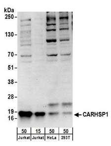CAPRIN1 Antibody - Detection of human CARHSP1 by western blot. Samples: Whole cell lysate from Jurkat (15 and 50 µg), HeLa (50µg), and HEK293T (50µg) cells. Antibodies: Affinity purified rabbit anti-CARHSP1 antibody used for WB at 0.4 µg/ml. Detection: Chemiluminescence with an exposure time of 30 seconds.